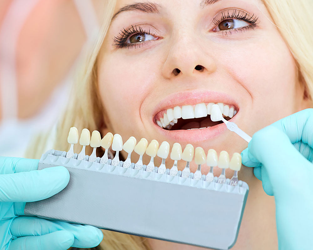 Teeth Whitening Supplies